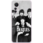 Чехол BoxFace Xiaomi 12 Lite 