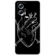 Чехол BoxFace Poco X4 GT 