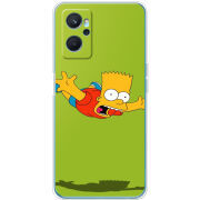 Чехол BoxFace Realme 9i 