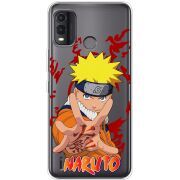 Прозрачный чехол BoxFace Nokia G11 Plus Naruto