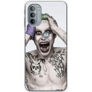 Чехол BoxFace Motorola G31 