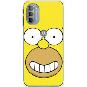 Чехол BoxFace Motorola G31 