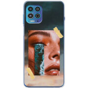 Чехол BoxFace Motorola G100 