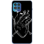 Чехол BoxFace Motorola G100 