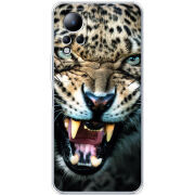Чехол BoxFace Infinix Note 11 