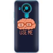 Чехол BoxFace Nokia 3.4 