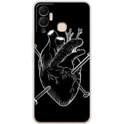 Чехол BoxFace Infinix Hot 12 Play 