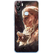 Чехол BoxFace Infinix Hot 12i 