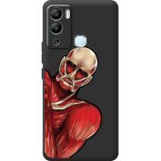 Черный чехол BoxFace Infinix Hot 12i Титан