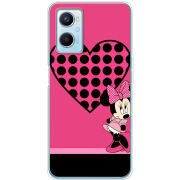 Чехол BoxFace OPPO A96 