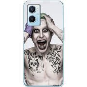 Чехол BoxFace OPPO A96 