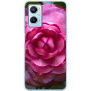 Чехол BoxFace OPPO A96 