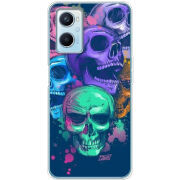 Чехол BoxFace OPPO A96 
