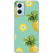 Чехол BoxFace OPPO A96 