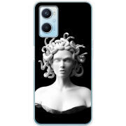 Чехол BoxFace OPPO A96 