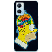Чехол BoxFace OPPO A96 