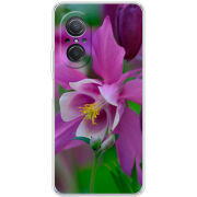 Чехол BoxFace Huawei Nova 9 SE 