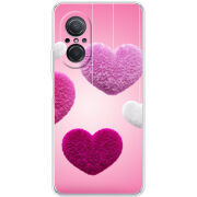 Чехол BoxFace Huawei Nova 9 SE 