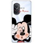 Прозрачный чехол BoxFace Huawei Nova 9 SE Mister M