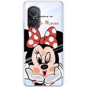 Прозрачный чехол BoxFace Huawei Nova 9 SE Lady M