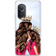 Прозрачный чехол BoxFace Huawei Nova 9 SE Queen and Princess