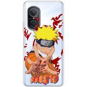 Прозрачный чехол BoxFace Huawei Nova 9 SE Naruto