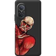 Черный чехол BoxFace Huawei Nova 9 SE Титан