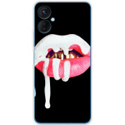 Чехол BoxFace Tecno Spark 9 Pro 