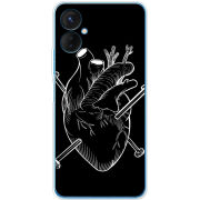 Чехол BoxFace Tecno Spark 9 Pro 