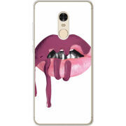 Чехол Uprint Xiaomi Redmi Note 4x 