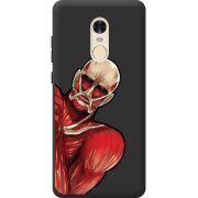 Черный чехол BoxFace Xiaomi Redmi Note 4 Титан