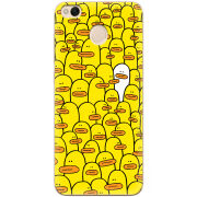 Чехол Uprint Xiaomi Redmi 4x Yellow Ducklings
