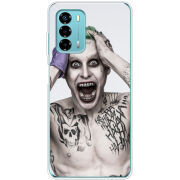 Чехол BoxFace ZTE Blade V40 Vita 