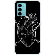 Чехол BoxFace ZTE Blade V40 Vita 