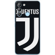 Чехол BoxFace Tecno POP 5 LTE FC J
