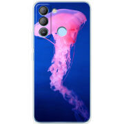 Чехол BoxFace Tecno POP 5 LTE 