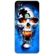 Чехол BoxFace Blackview A70 