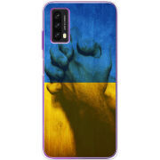 Чехол BoxFace Blackview A90 Handshake