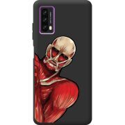 Черный чехол BoxFace Blackview A90 Титан