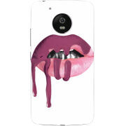 Чехол Uprint Motorola Moto G5 XT1676 