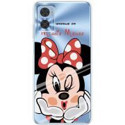 Прозрачный чехол BoxFace Motorola E22/E22i Lady M