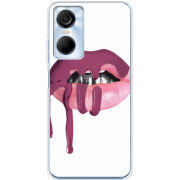 Чехол BoxFace Tecno POP 6 Pro 