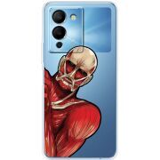 Прозрачный чехол BoxFace Infinix Note 12 (G96) Титан