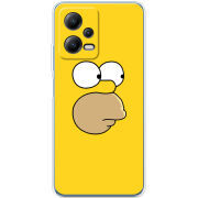 Чехол BoxFace Xiaomi Poco X5 5G 
