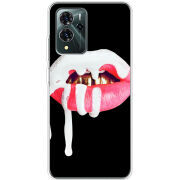 Чехол BoxFace ZTE Blade V40 Pro 