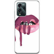 Чехол BoxFace ZTE Blade V40 Pro 