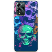 Чехол BoxFace ZTE Blade V40 Pro 