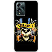 Чехол BoxFace ZTE Blade V40 Pro 