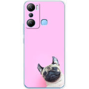 Чехол BoxFace Infinix Hot 20i 