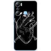 Чехол BoxFace Infinix Hot 20i 